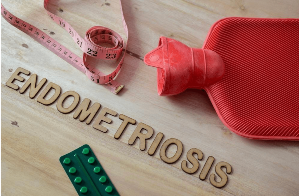 Endometriosis: A Guide for Women