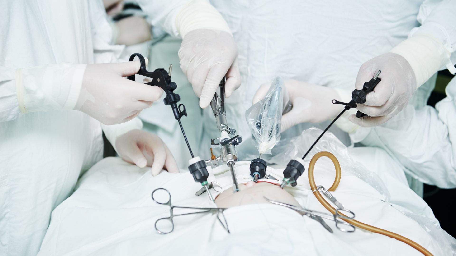 laparoscopic gynecology surgery Hyderabad